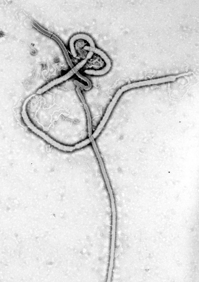 Ebola-Virus (CDC/ Dr. Frederick A. Murphy)