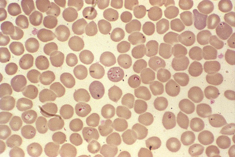 Babesien innerhalb von Erythrozyten in einem Blutausstrich. Babesien im Blutausstrich. Die Zellkerne der Erreger stellen sich in der Giemsa-Färbung als leuchtend rote Flecken auf den roten Blutkörperchen dar. Giemsa-Färbung eines Blutausstrichs mit Babesien (CDC)