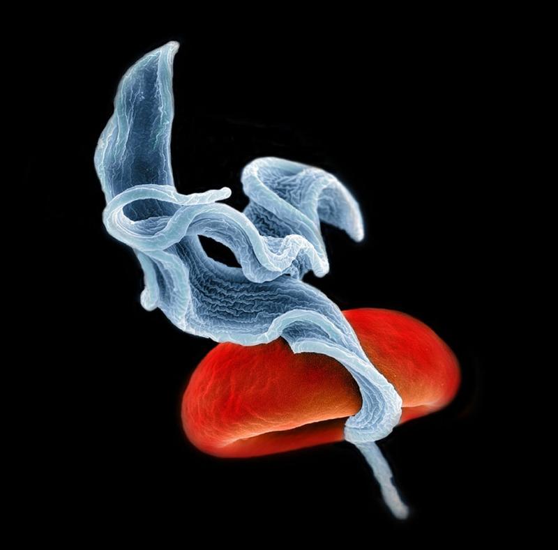 Rasterelektronenmikroskop-Aufnahme zweier Trypanosomen (blau), die im Blut schwimmen. Bei der runden Struktur handelt es sich um ein rotes Blutkörperchen (Christopher Jackson)