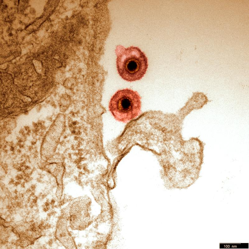 Aufnahme mit einem Elektronenmikroskop: Herpesviruspatikel. (Walid Azab)